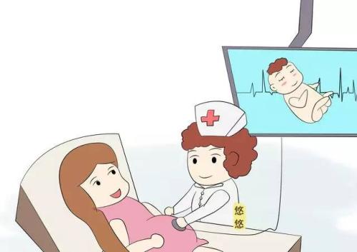 做四维彩超